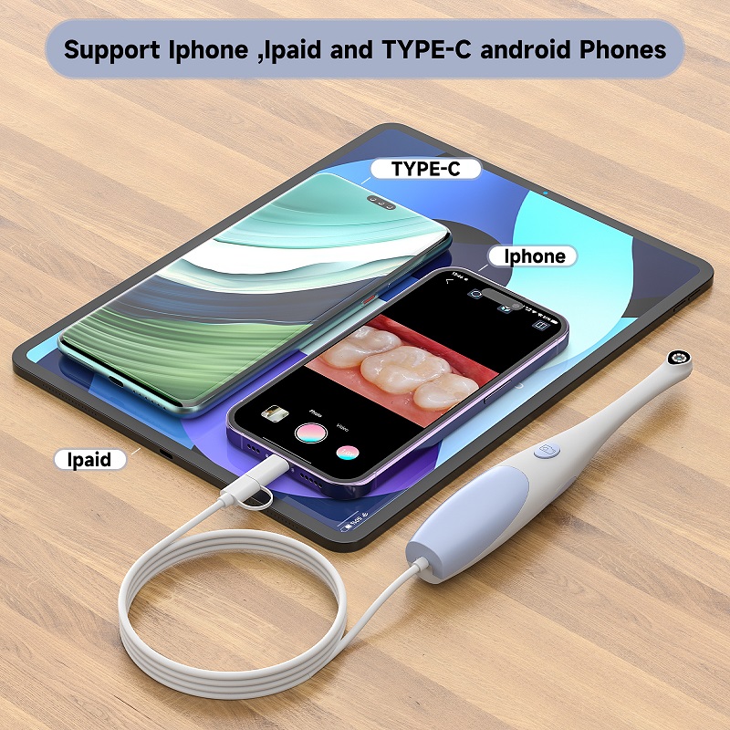 TYPE-C Visuelle Oralkamera für – Endoscope Inspection Camera Bewertung und Preis